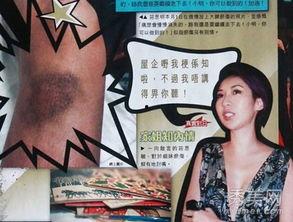 遭遇暴力的明星